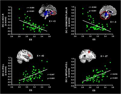 Altered Brain Connectivity Patterns of Individual Differences in Insightful Problem Solving